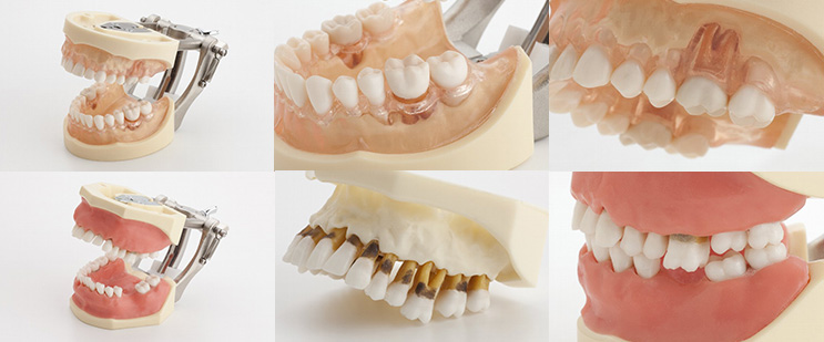 Periodontic Series